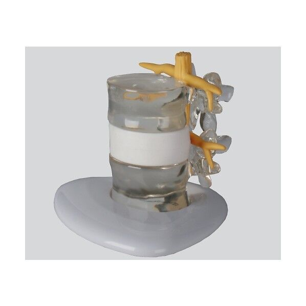 ヘルニアモデル 190×160×140 8-8422-01 1